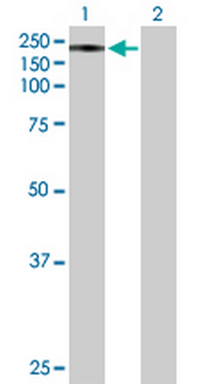 STARD8 Antibody in Western Blot (WB)