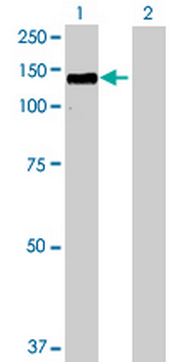 HDAC4 Antibody in Western Blot (WB)