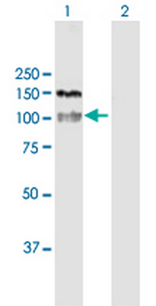 HDAC4 Antibody in Western Blot (WB)