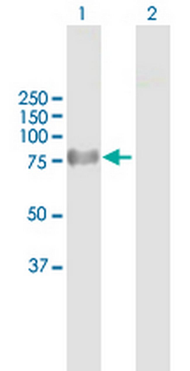 ProSAPiP1 Antibody in Western Blot (WB)
