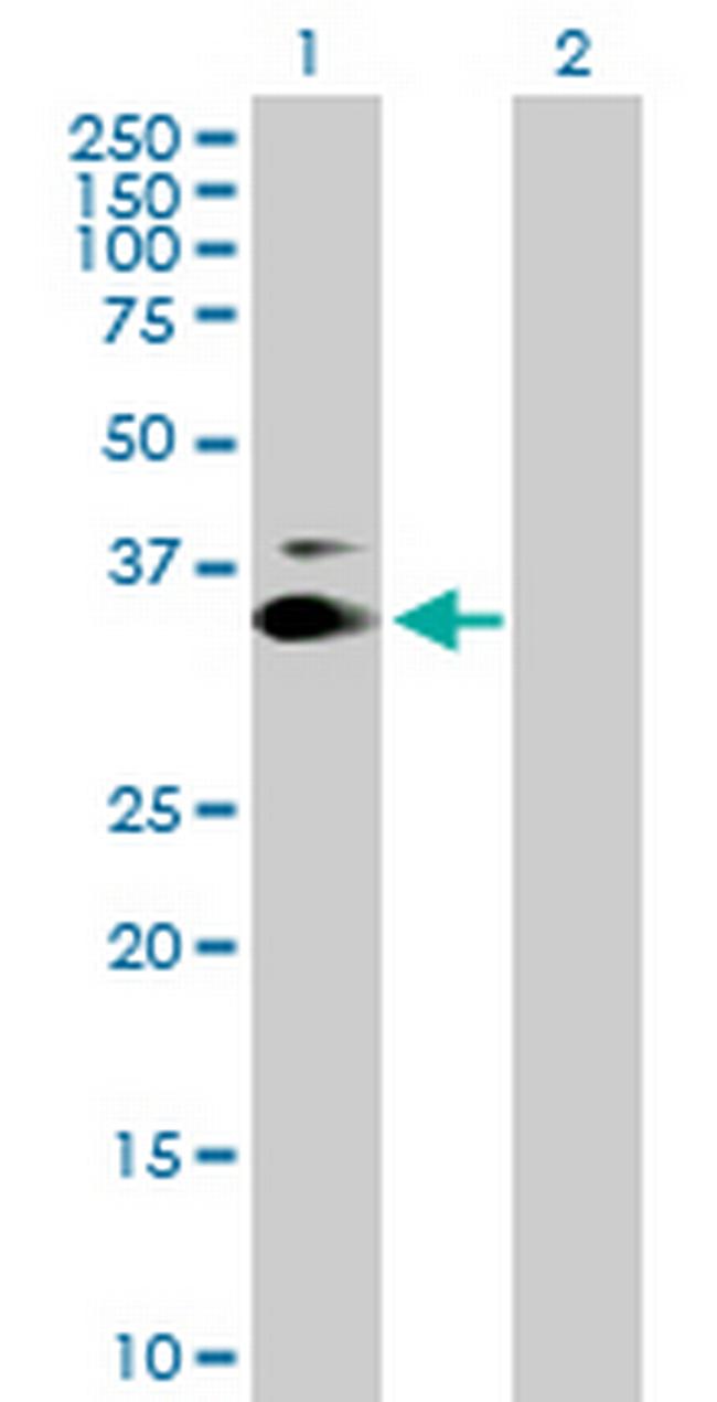 KIAA0247 Antibody in Western Blot (WB)