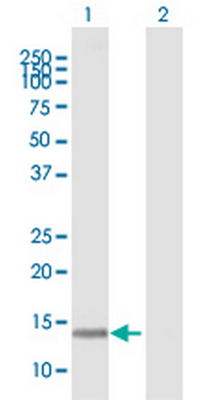 KIAA0101 Antibody in Western Blot (WB)