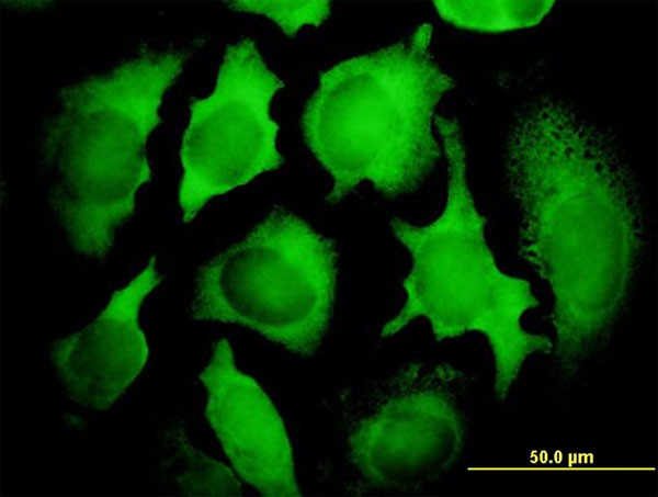 KIAA0101 Antibody in Immunocytochemistry (ICC/IF)