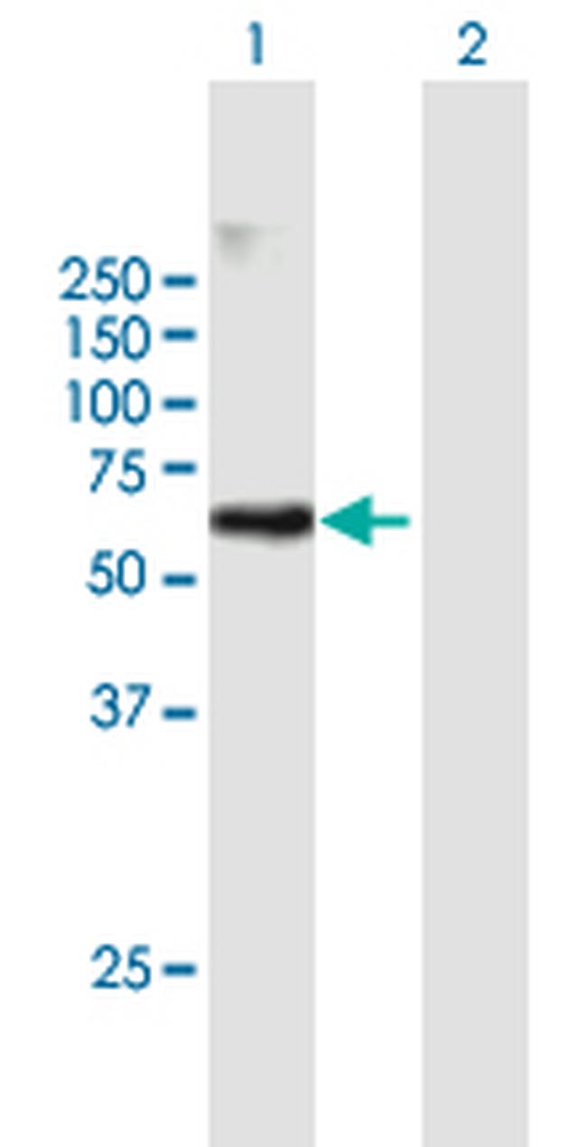 RAPGEF5 Antibody in Western Blot (WB)
