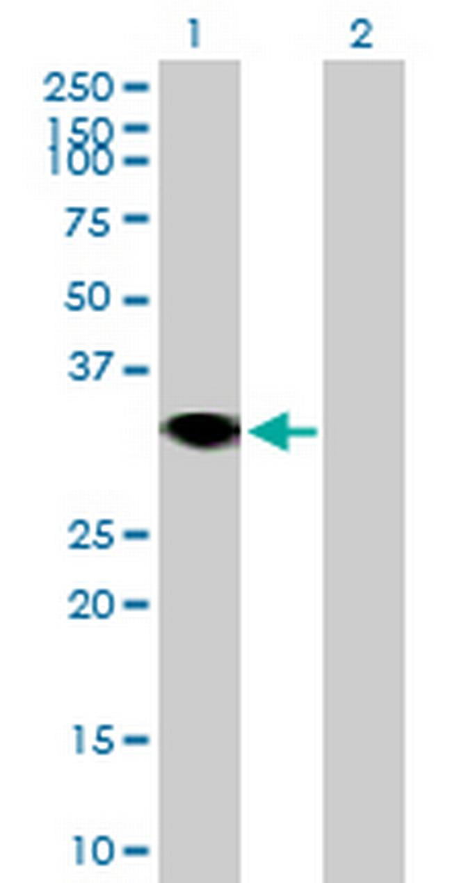 RNF144A Antibody in Western Blot (WB)