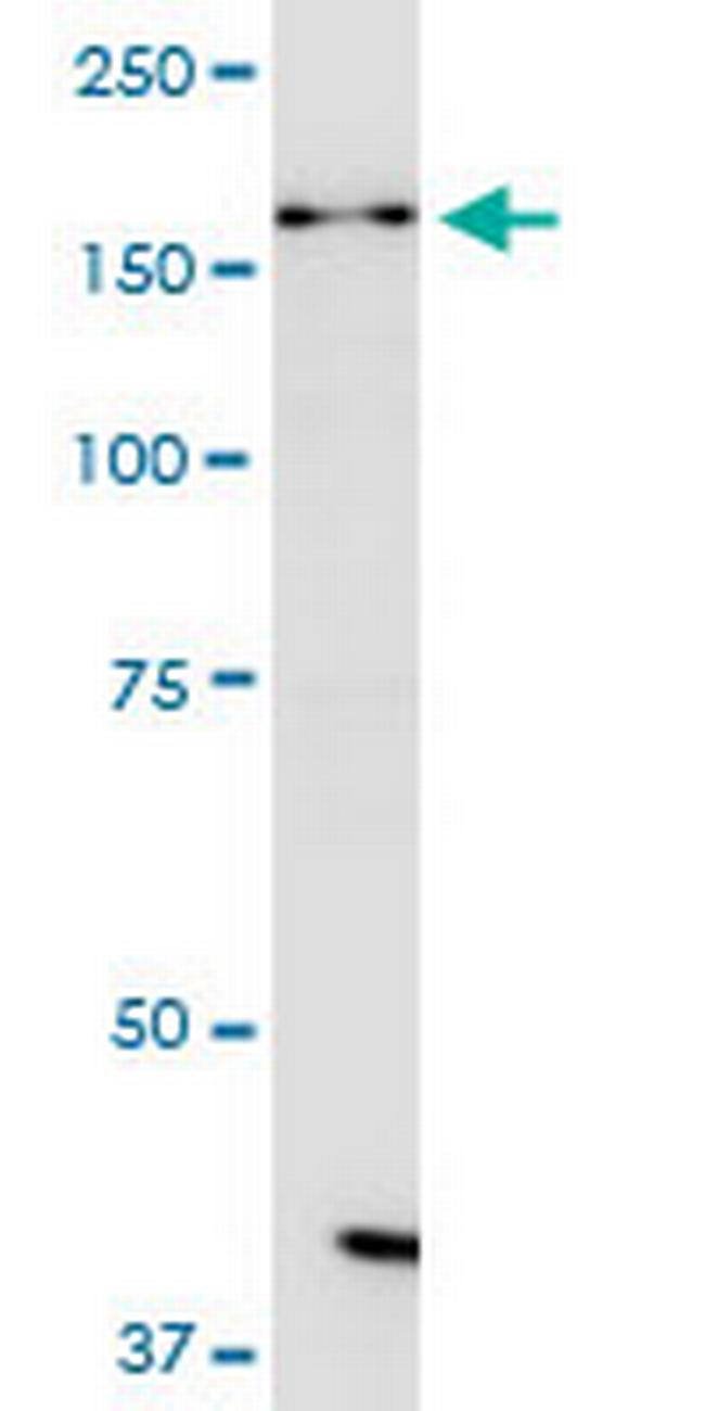 DHX38 Antibody in Western Blot (WB)