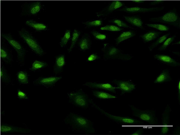 GIT2 Antibody in Immunocytochemistry (ICC/IF)