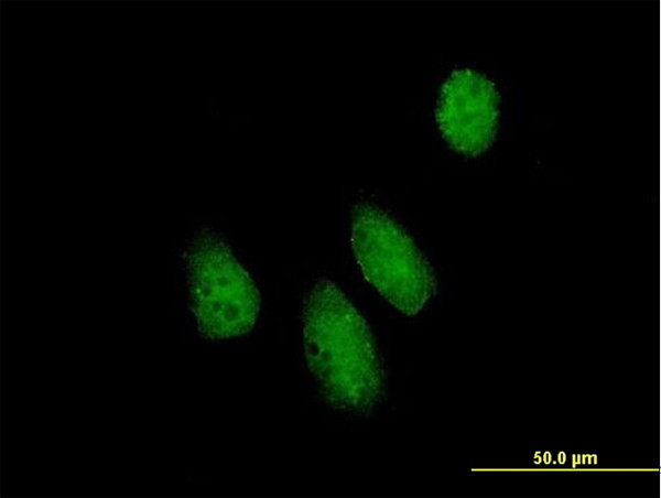 NUPL1 Antibody in Immunocytochemistry (ICC/IF)