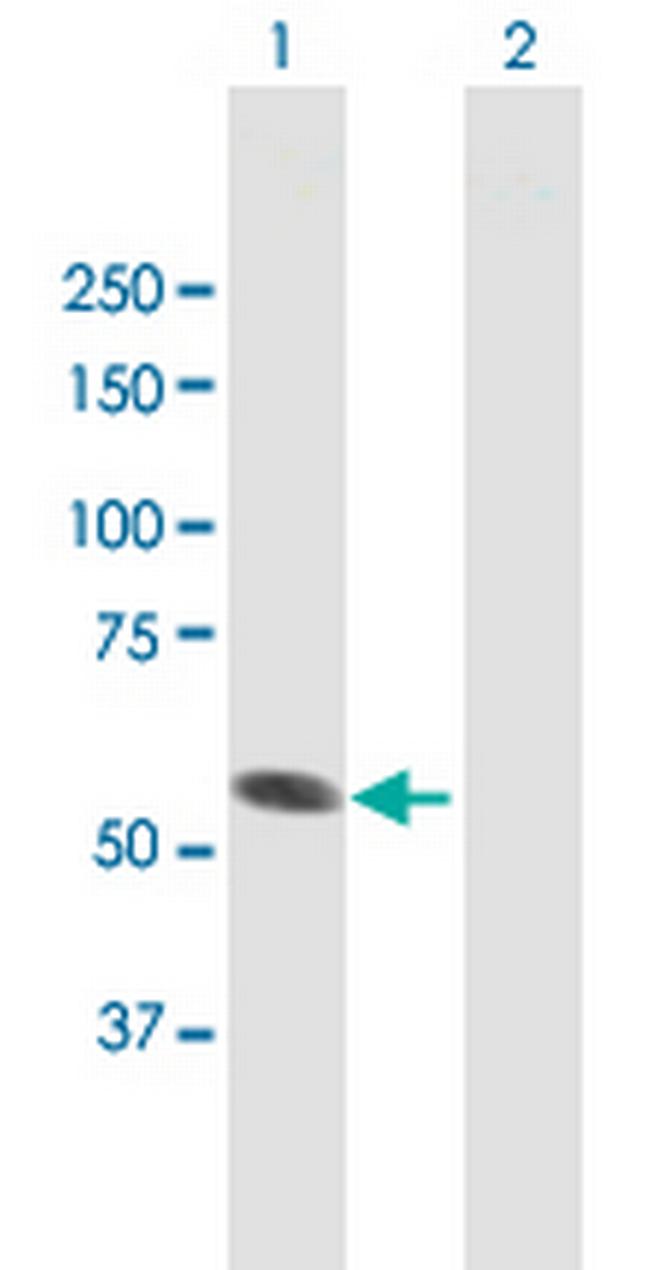 SPATA2 Antibody in Western Blot (WB)