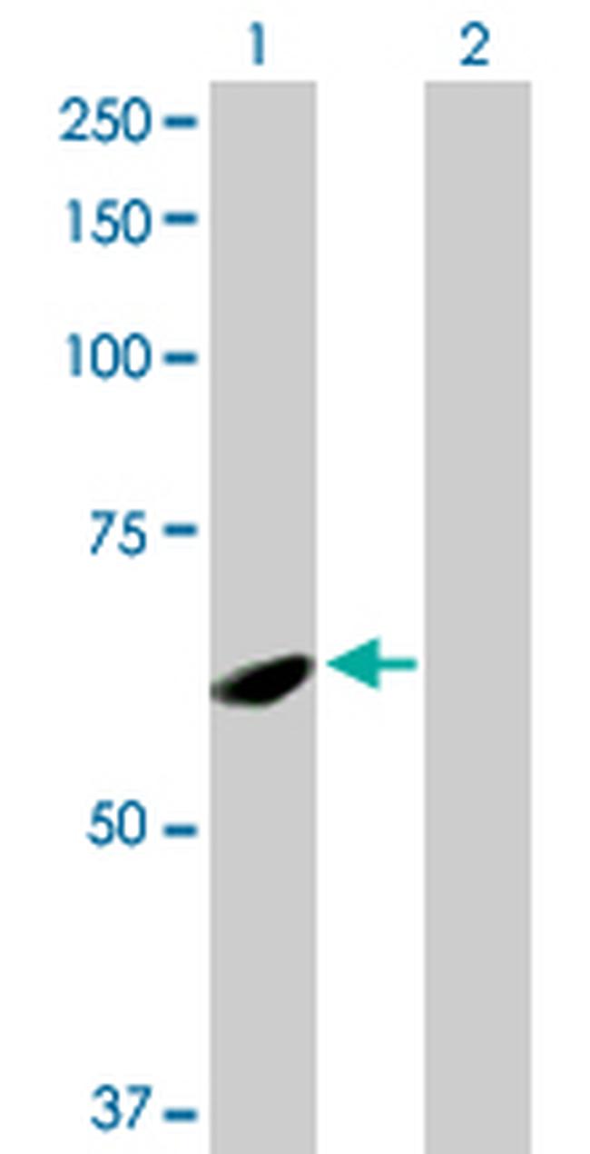 SPATA2 Antibody in Western Blot (WB)