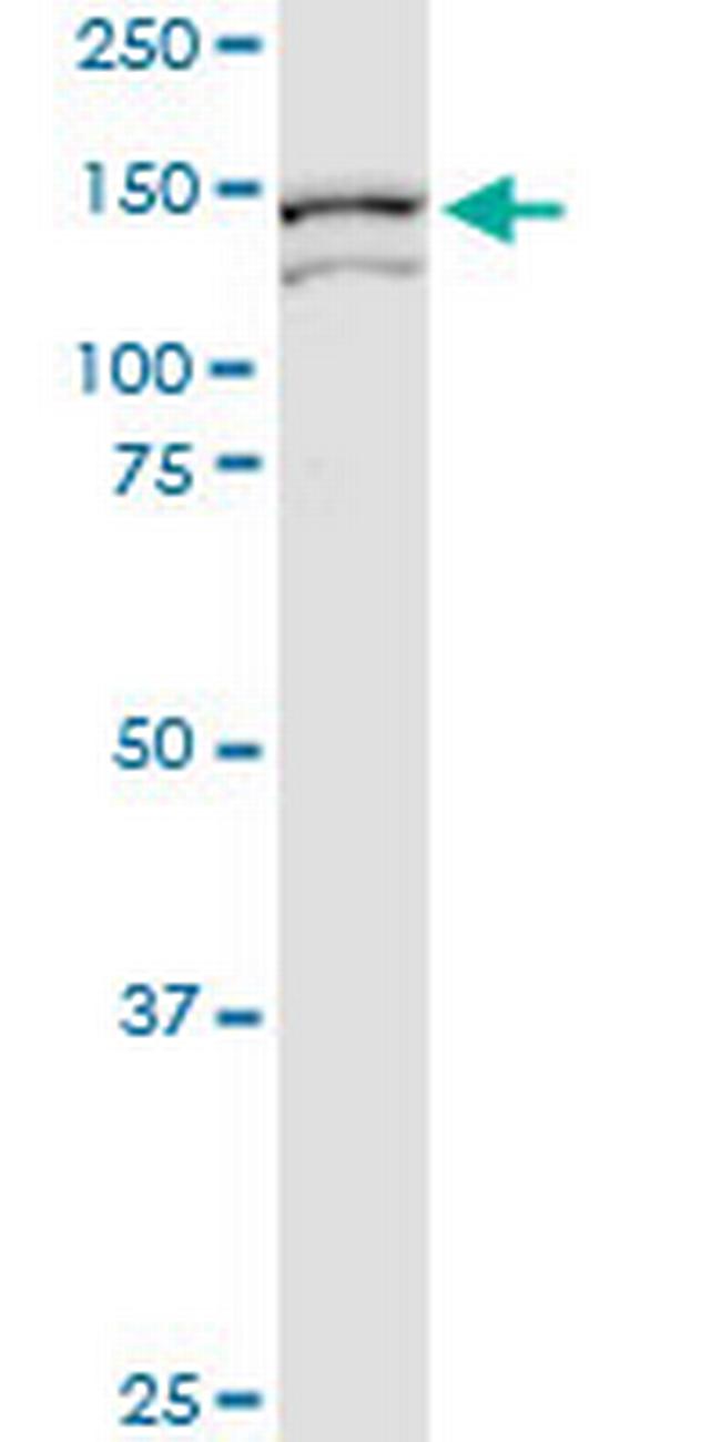 ARHGEF11 Antibody in Western Blot (WB)
