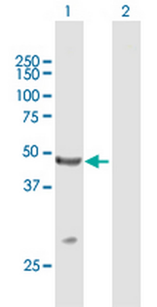 TRIM14 Antibody in Western Blot (WB)