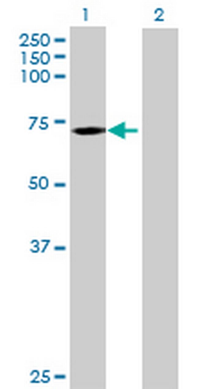 EPM2AIP1 Antibody in Western Blot (WB)
