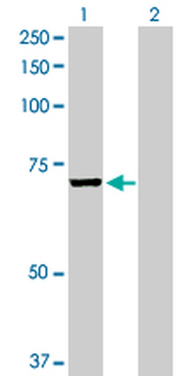 EPM2AIP1 Antibody in Western Blot (WB)