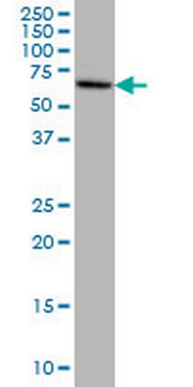 EPM2AIP1 Antibody in Western Blot (WB)