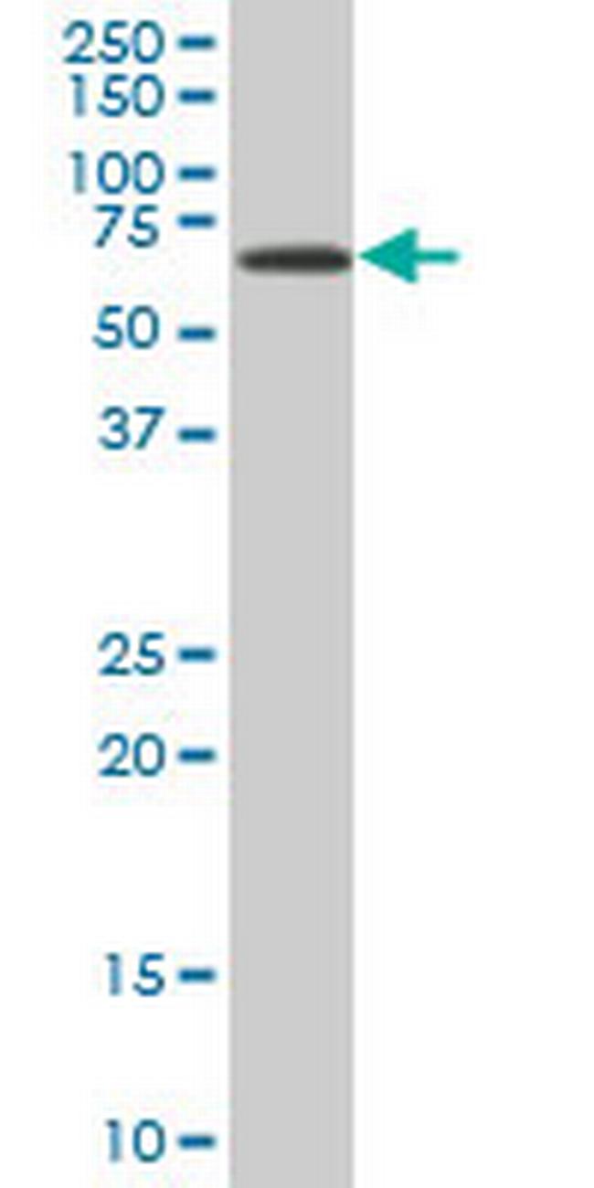 EPM2AIP1 Antibody in Western Blot (WB)