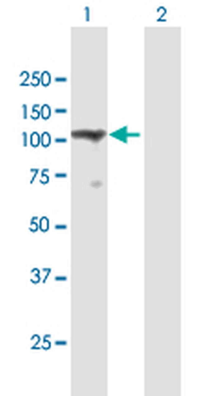 TMEM24 Antibody in Western Blot (WB)