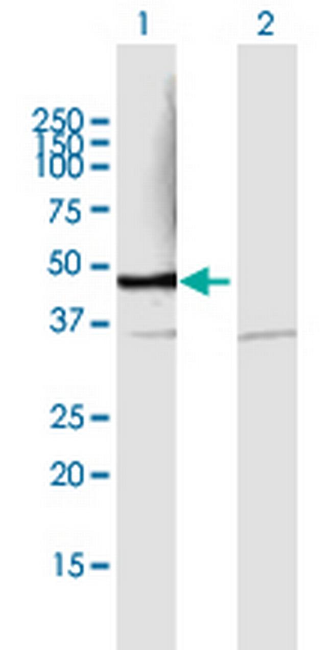 PSMD6 Antibody in Western Blot (WB)