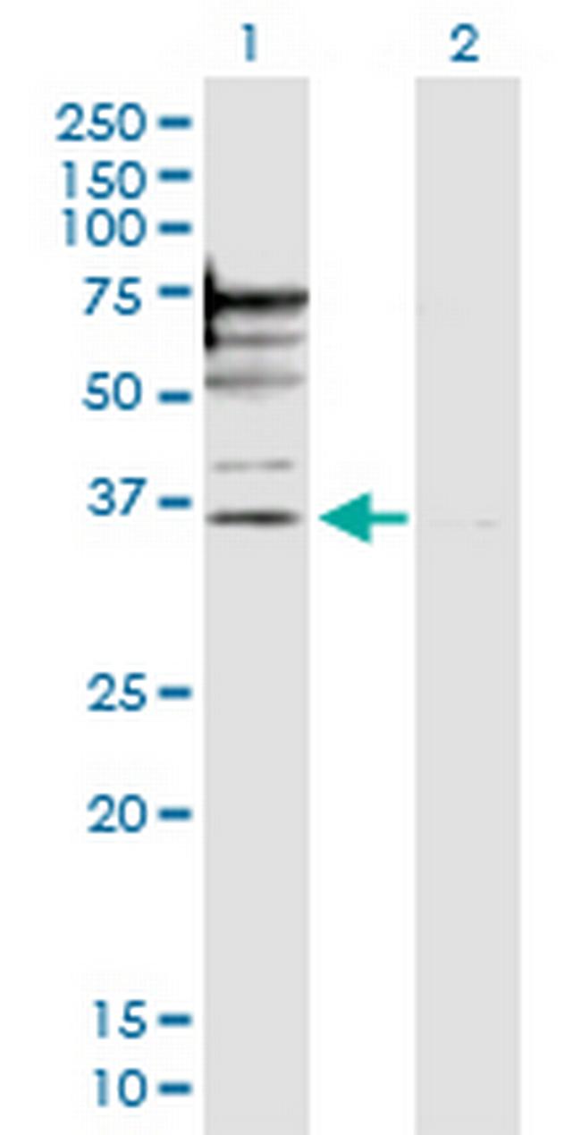 PSMD6 Antibody in Western Blot (WB)