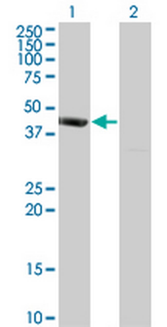 PSMD6 Antibody in Western Blot (WB)