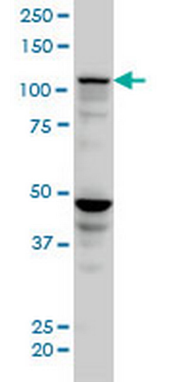SEC24D Antibody in Western Blot (WB)