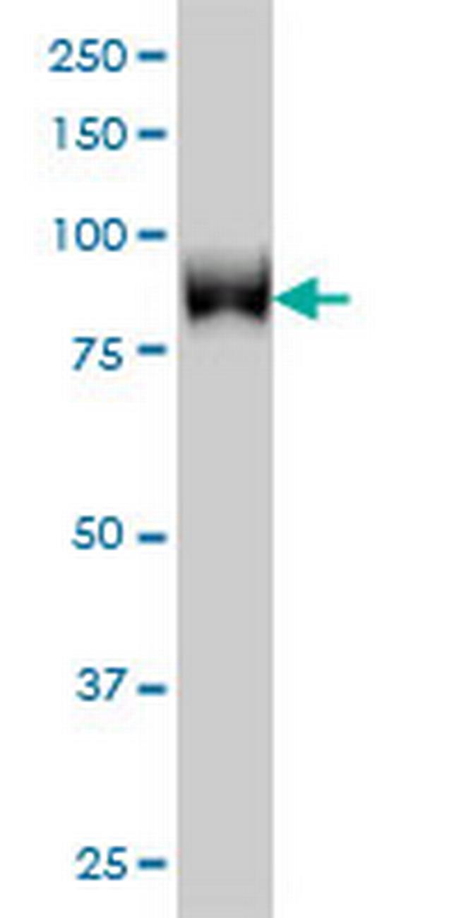 TLK1 Antibody in Western Blot (WB)