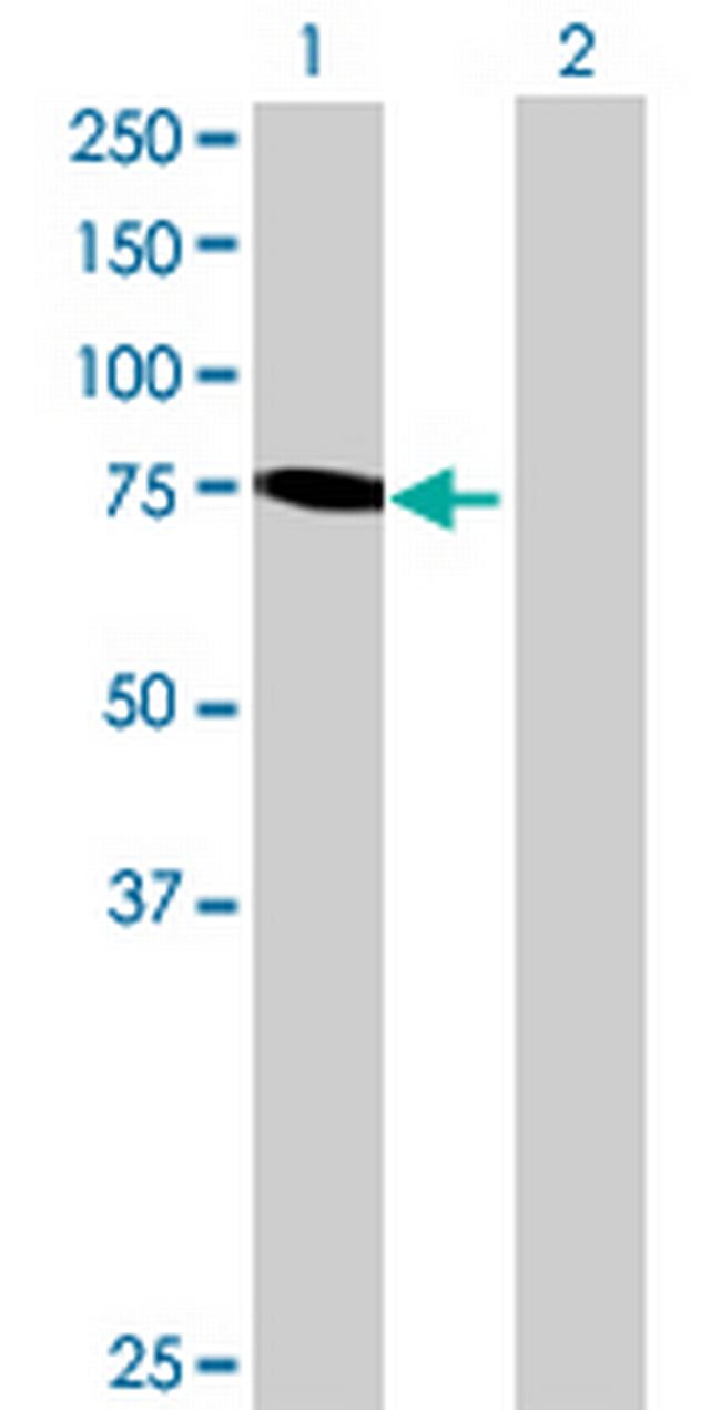 RHOBTB1 Antibody in Western Blot (WB)