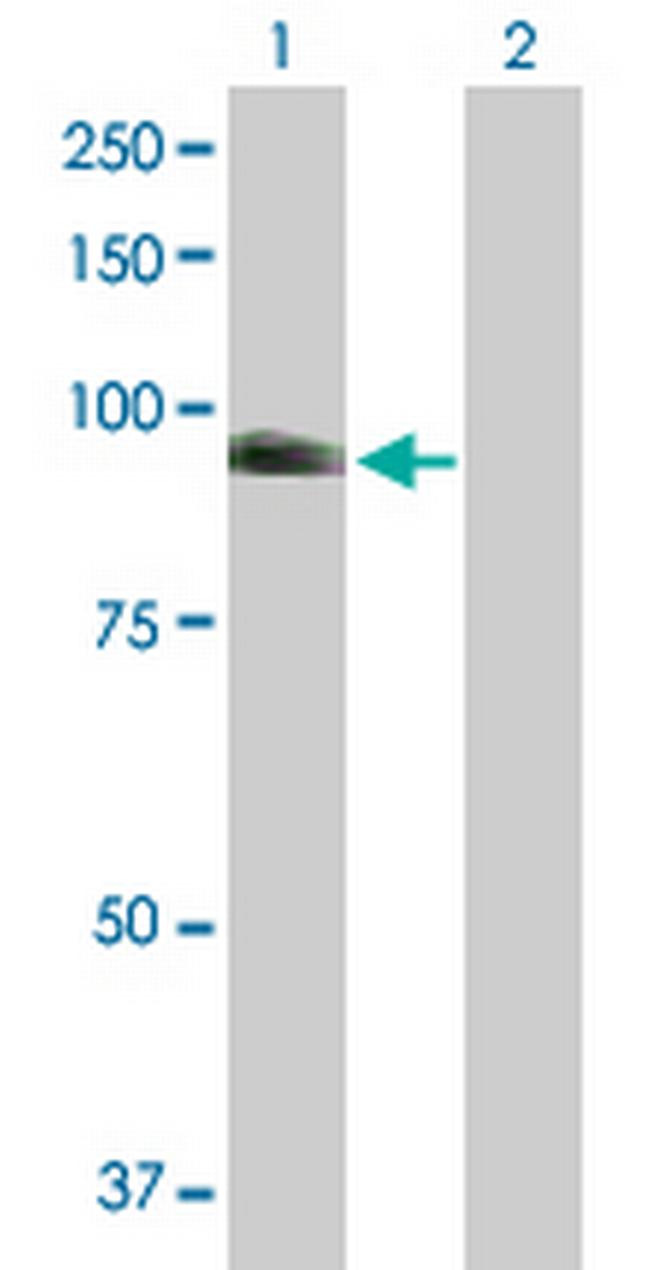 NUAK1 Antibody in Western Blot (WB)