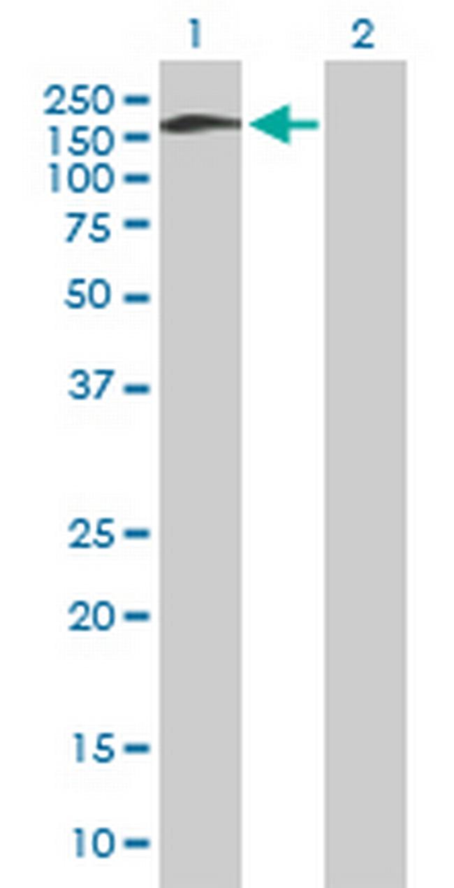 SNAP91 Antibody in Western Blot (WB)