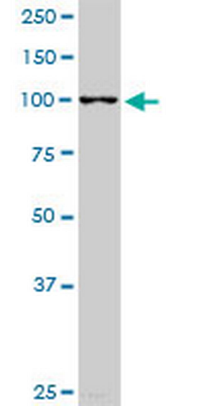 RABGAP1L Antibody in Western Blot (WB)