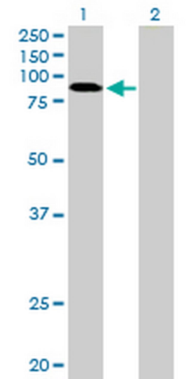 RNF10 Antibody in Western Blot (WB)