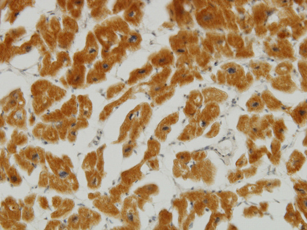 MFN2 Antibody in Immunohistochemistry (Paraffin) (IHC (P))