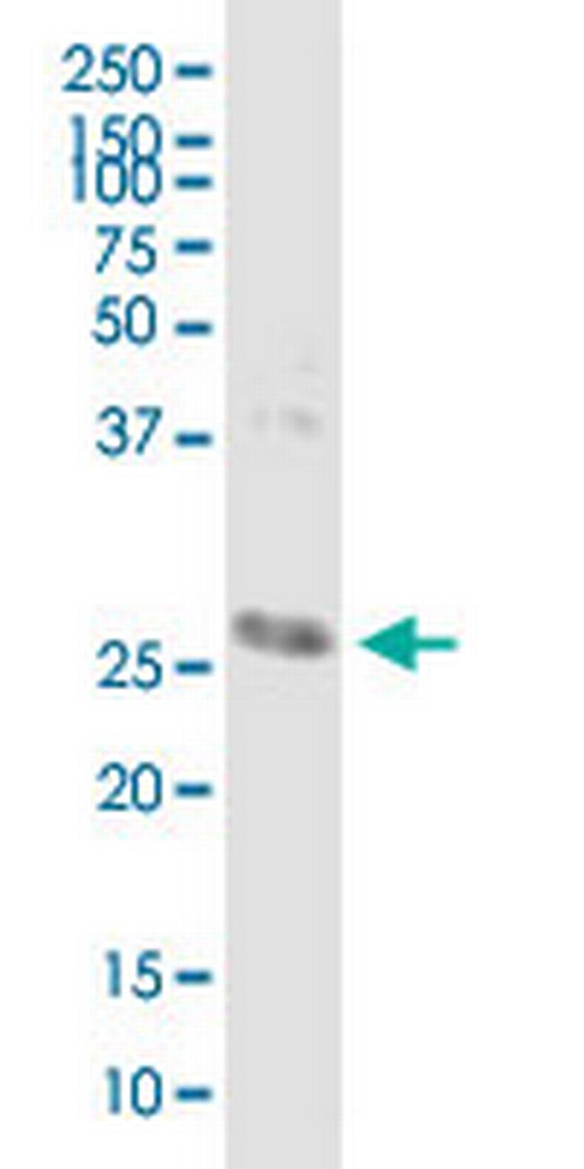 CD302 Antibody in Western Blot (WB)