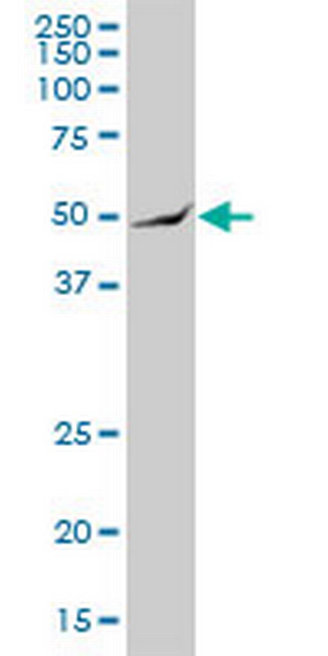 ARHGAP25 Antibody in Western Blot (WB)