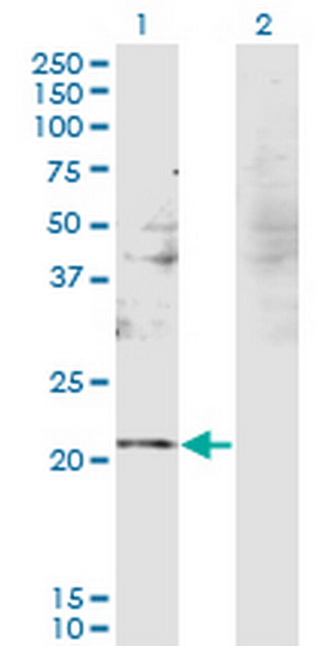 RBM8A Antibody in Western Blot (WB)