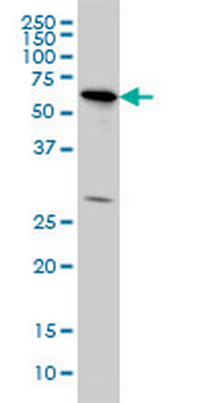 OXSR1 Antibody in Western Blot (WB)