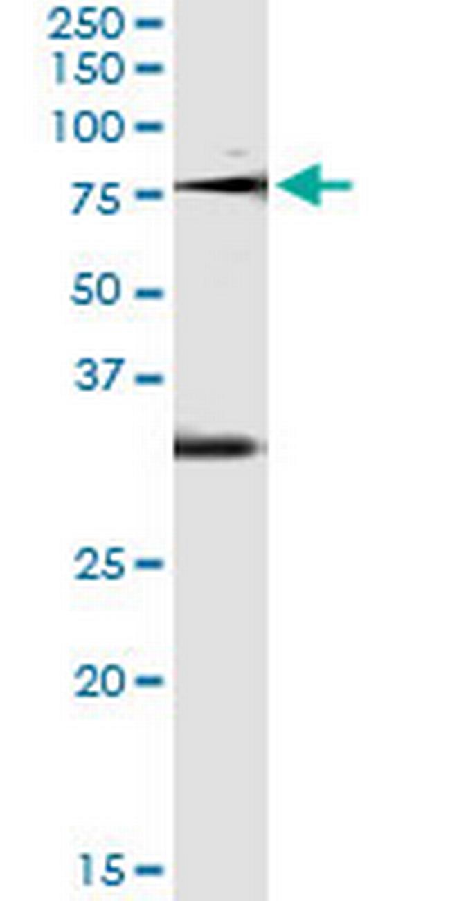 OXSR1 Antibody in Immunoprecipitation (IP)