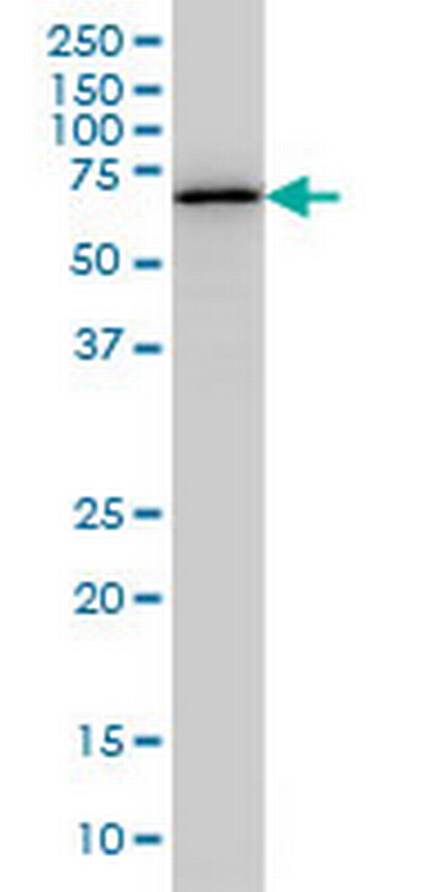 OXSR1 Antibody in Western Blot (WB)