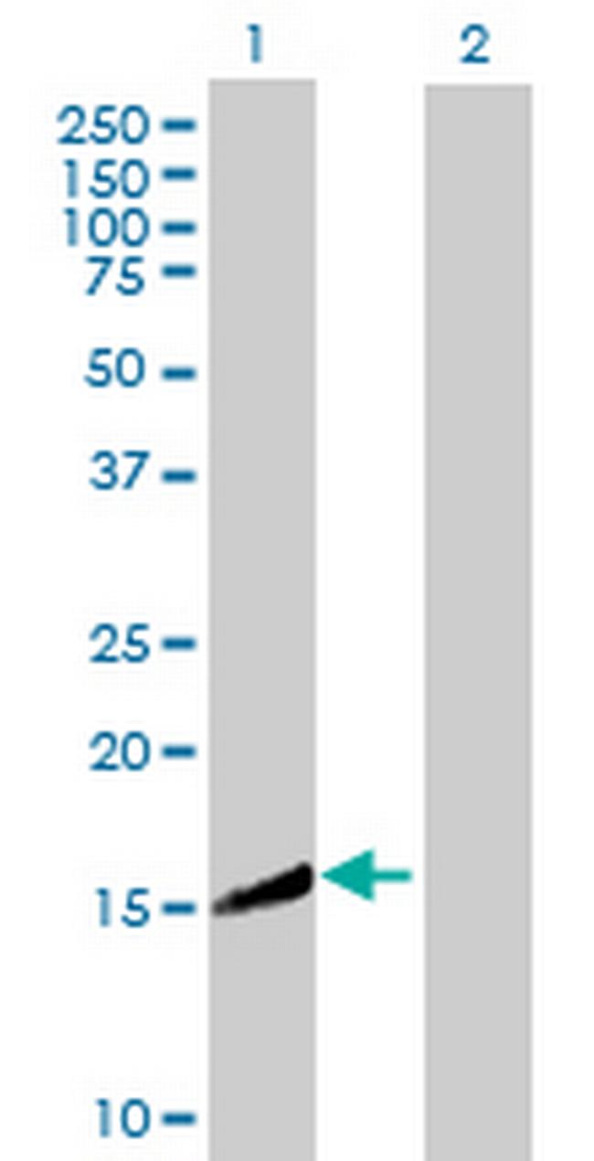 CRYZL1 Antibody in Western Blot (WB)