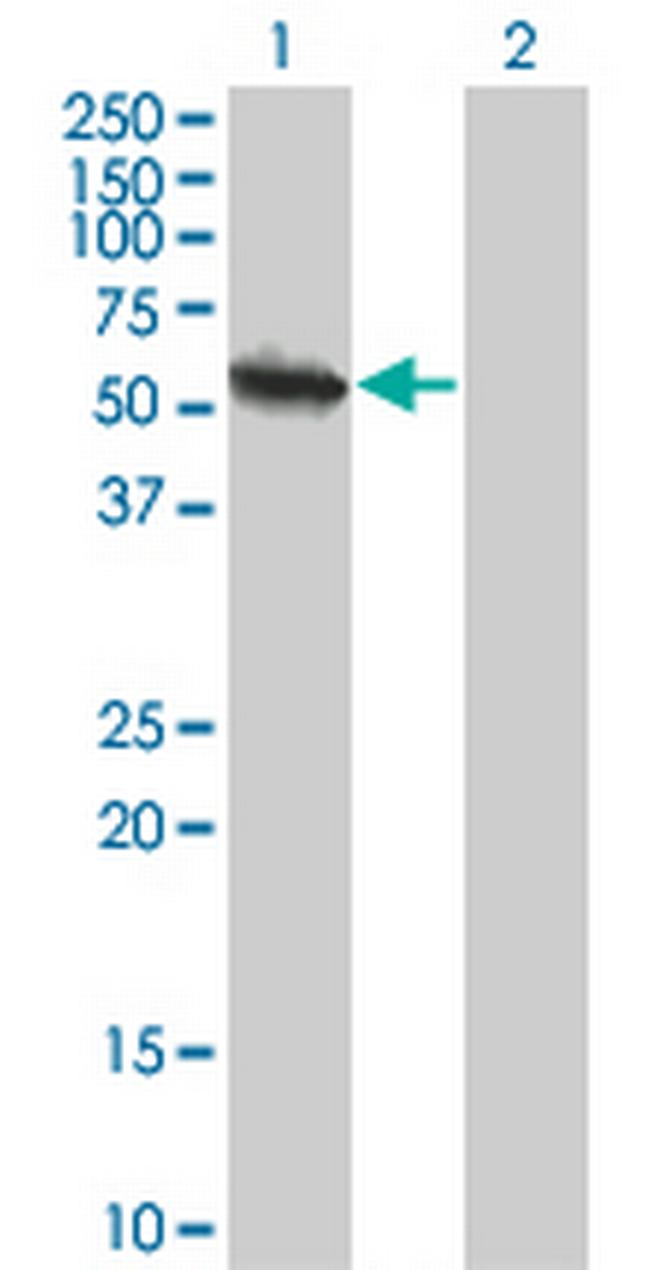 USP3 Antibody in Western Blot (WB)