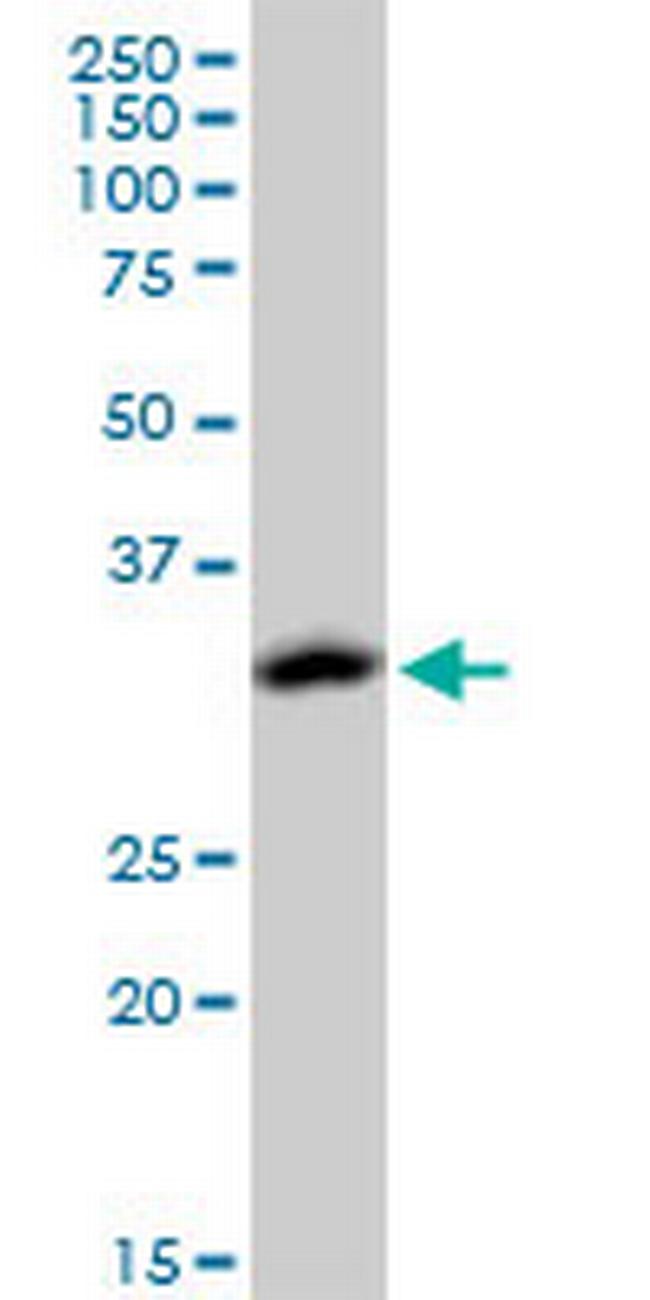 ACOT8 Antibody in Western Blot (WB)