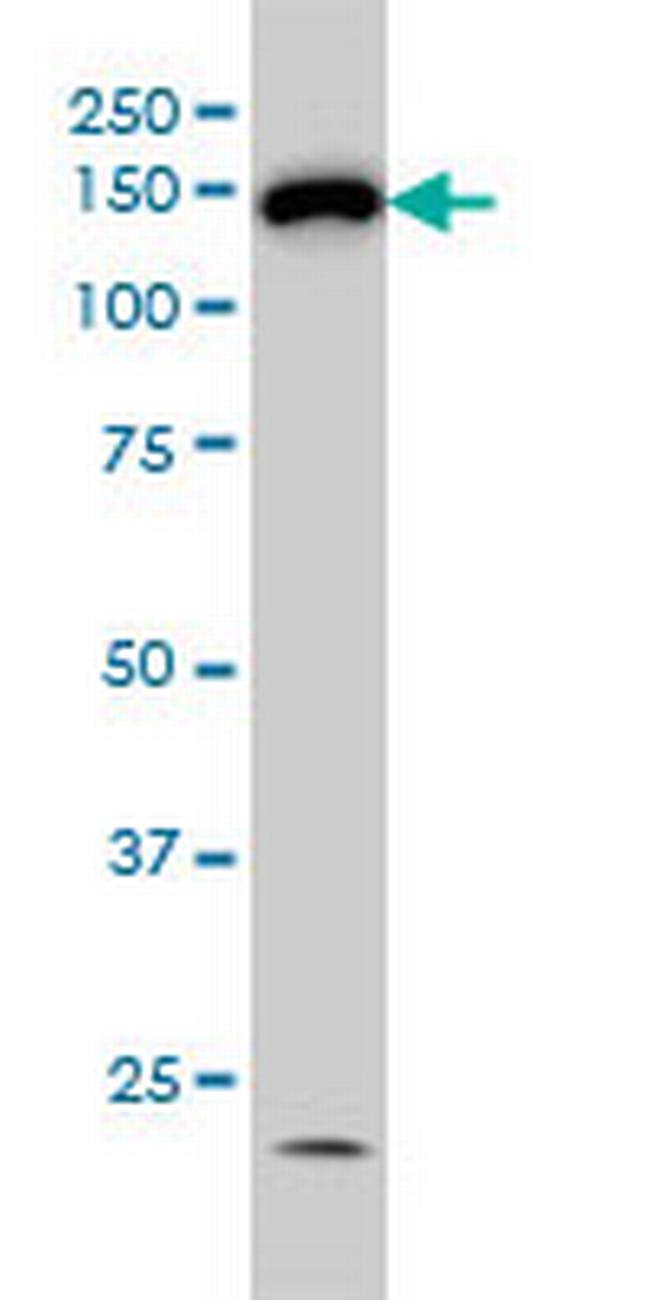HDAC6 Antibody in Western Blot (WB)