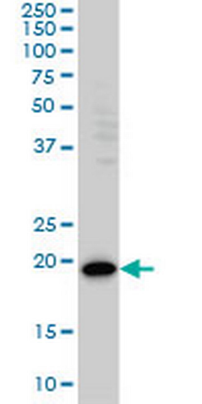 PDCD6 Antibody in Western Blot (WB)