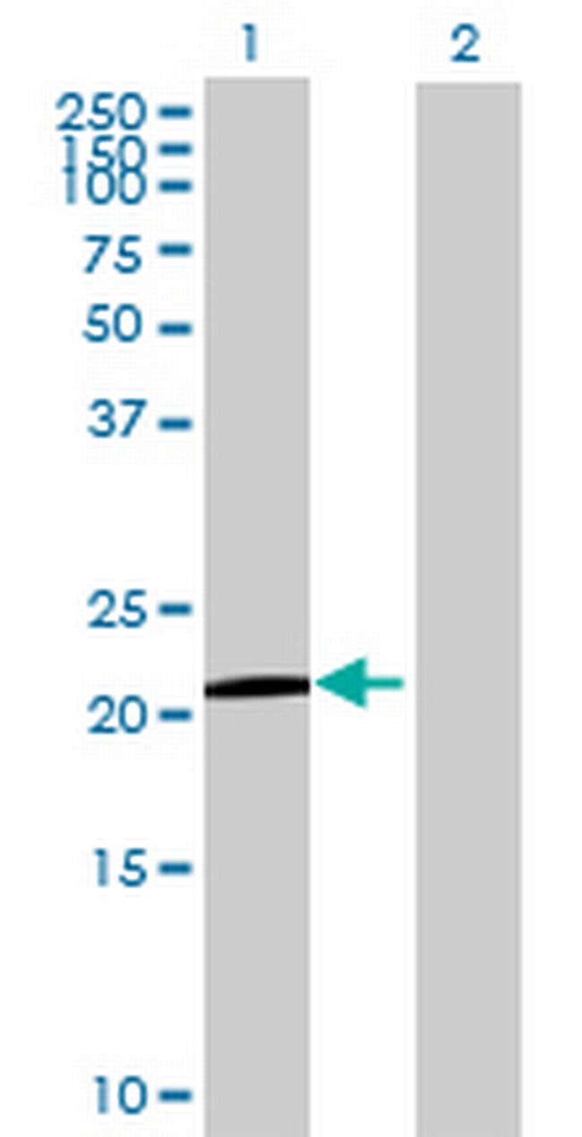 BCL2L10 Antibody in Western Blot (WB)