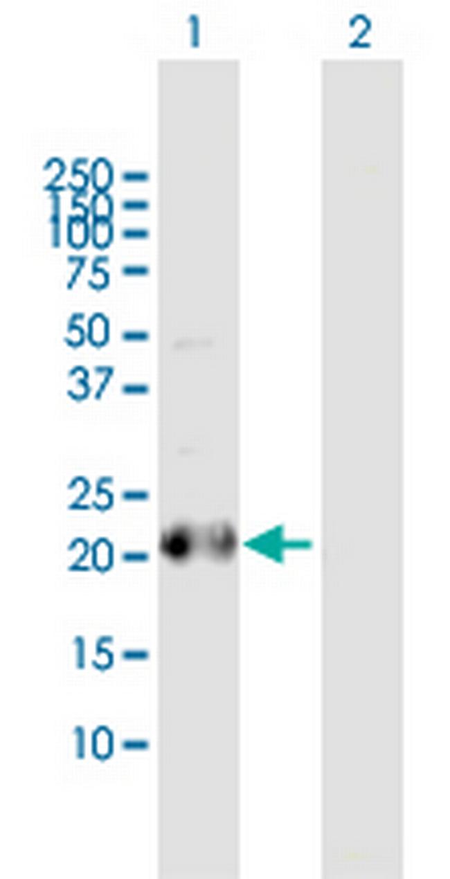 BCL2L10 Antibody in Western Blot (WB)