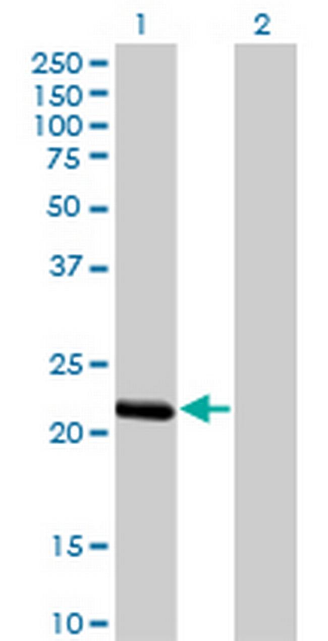 BCL2L10 Antibody in Western Blot (WB)