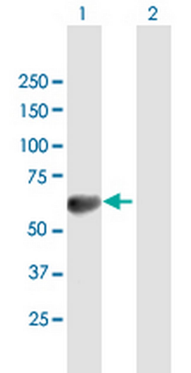 TOM1 Antibody in Western Blot (WB)
