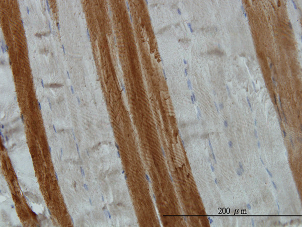 TOM1 Antibody in Immunohistochemistry (Paraffin) (IHC (P))