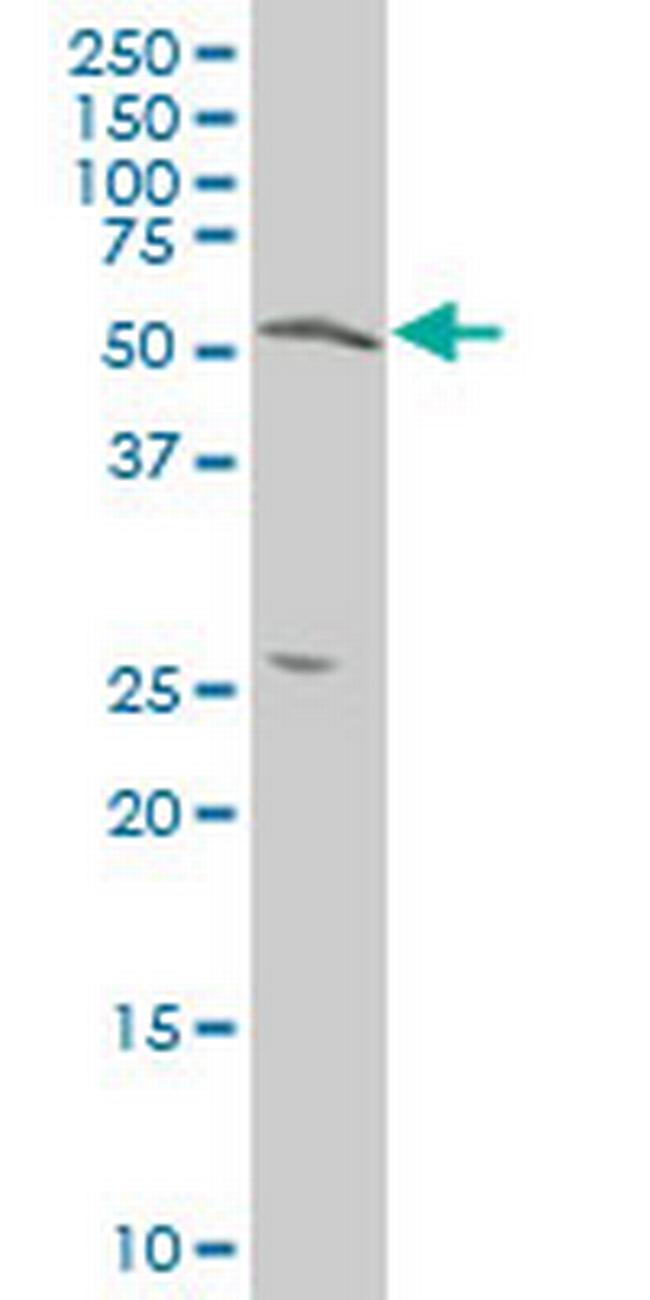 TOM1 Antibody in Western Blot (WB)