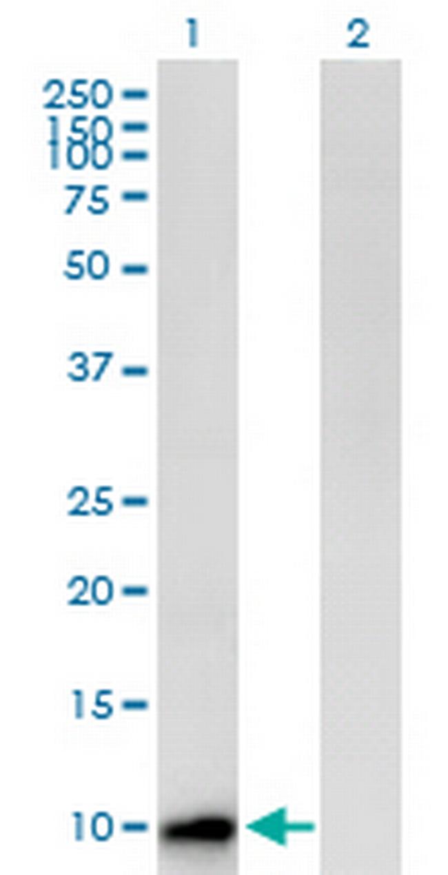 CST8 Antibody in Western Blot (WB)